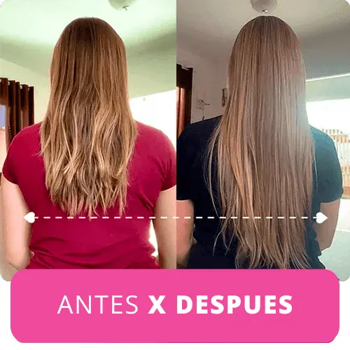 ANTES X DESPUES (1)