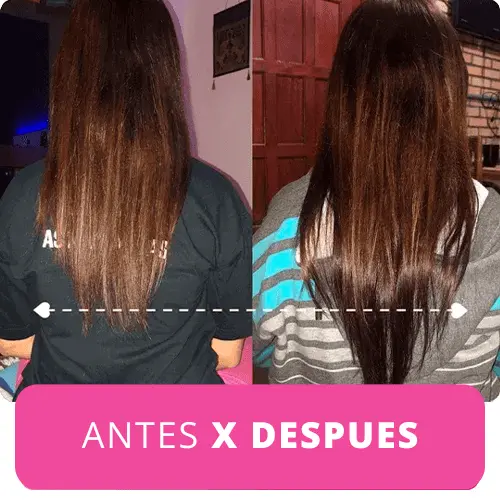 ANTES X DESPUES